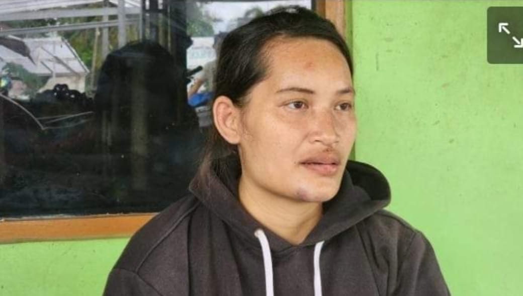 Kisah Korban Jambret yang Bayinya Tewas Jatuh ke Aspal di Jalan Muhibbin Banjar, Baru Obati Anak